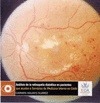 Portada de: ANALISIS DE LA RETINOPATIA DIABETICA EN PACIENTES QUE ACUDEN A SERVICIOS DE MEDI